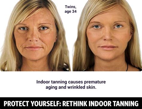 Images Of Health Risks Make Indoor Tanning Messages More Effective UNC Lineberger