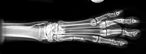 Radiographic Positioning Head Shoulders Knees And Toes Part 2