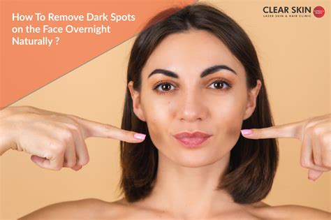 How To Remove Dark Spots On The Face Overnight Naturally
