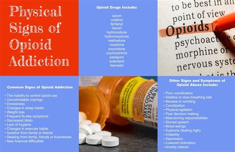 physical signs of opioid addiction recovery hope treatment