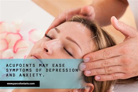 Does Acupuncture Help With Depression And Anxiety The Physiotherapy And Rehabilitation Centres