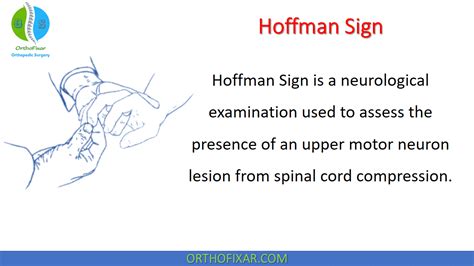 Hoffman Sign For Upper Motor Neuron