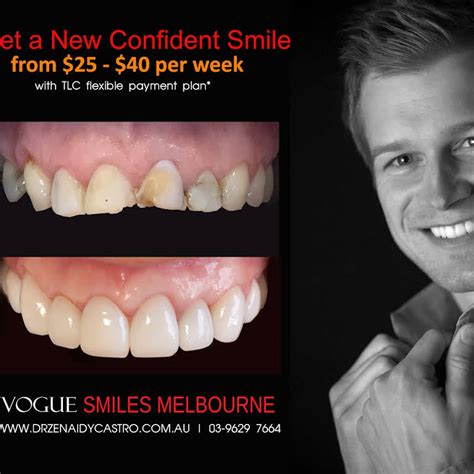 Vogue Smiles Melbourne Dentists In Melbourne CBD Cosmetic Smile