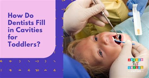 How Do Dentists Fill In Cavities For Toddlers Junior Smiles Of Stafford