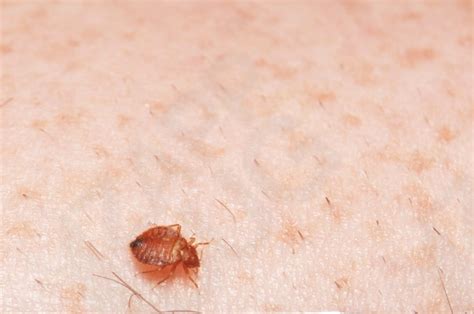 What Do Bed Bug Bites Look Like Zappbug