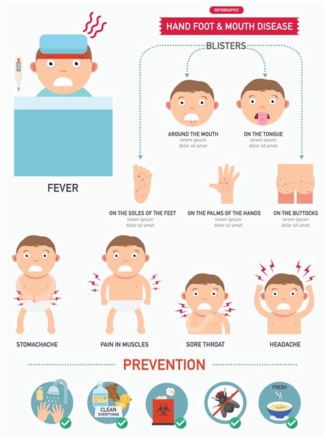 Hand Foot And Mouth Disease Infographic