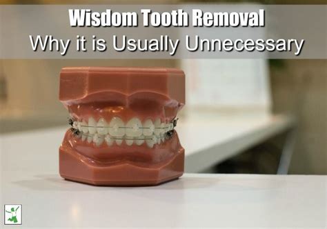 Maybe you would like to learn more about one of these? Why Most Wisdom Tooth Removal is Unnecessary - Healthy Home Economist | Dental, Wisdom teeth ...