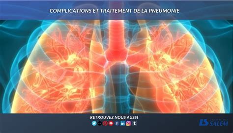 Complications Et Traitement De La Pneumonie Laboratoires Salem