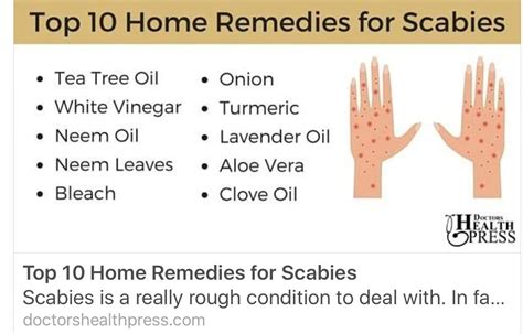 how to treat scabies a comprehensive guide ihsanpedia