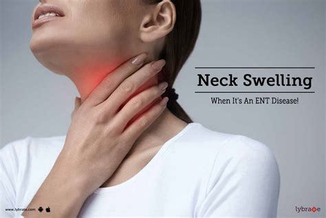 Neck Swelling When Its An Ent Disease By Dr Anjan Jyoti Bhuyan