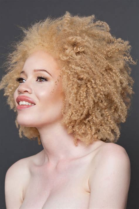 Unique Beauty Of Albino People Demilked