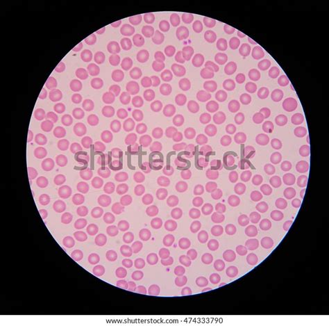 Under Microscope Blood Smear Showing Normal Stock Photo Edit Now