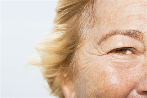 What Type Of Wrinkles Do You Have And How To Treat Them