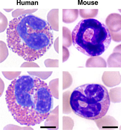 Human Versus Mouse Eosinophils “that Which We Call An Eosinophil By