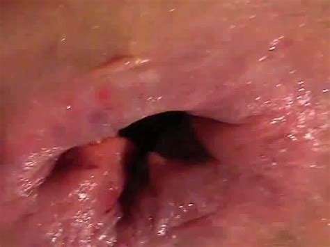 Anal Fucking During Pooping Scat Porn At Thisvid Tube
