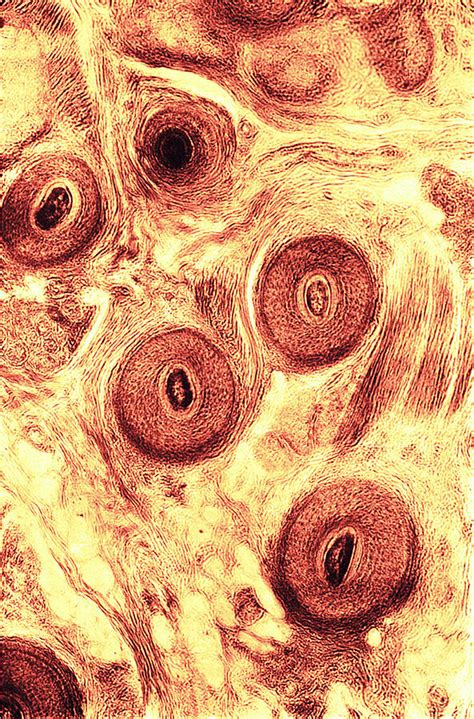 Human Scalp Early Photomicrograph 2 Photograph By Science Source Pixels