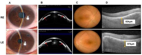 JCM Free Full Text Effect Of Combined Surgery In Patients With