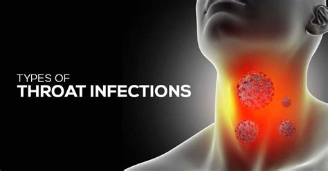 Throat Infections Overview Of Causestypes And Remedies Marham