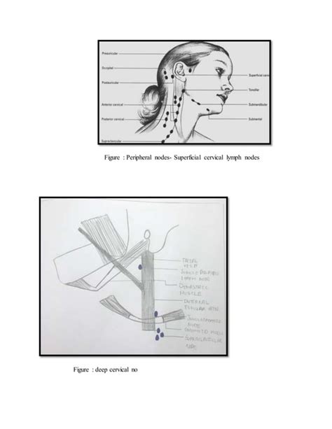 Lymph Nodes Of Head And Neck And Differential Diagnosis Of Cervical