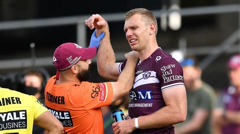 Don't take this down nrl i stg Tom Trbojevic injury: Manly Sea Eagles left devastated by latest blow to fullback | Sporting ...