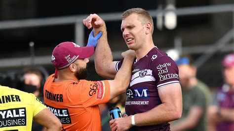 Unfortunately, kristi's actual date of birth is unavailable in. Tom Trbojevic injury: Manly Sea Eagles left devastated by ...