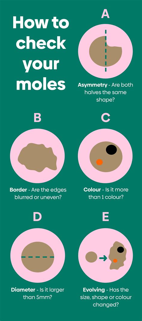 How To Check A Mole
