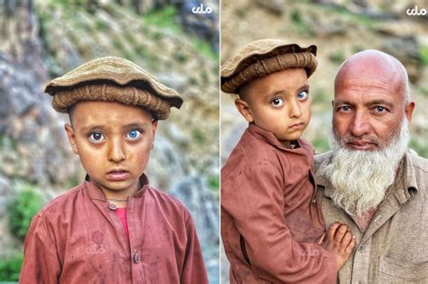 Photos Of Afghan Child With Unique Eye Colors Go Viral Khaama Press