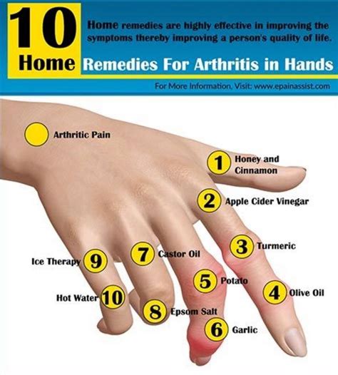 The Best Home Remedies For Rheumatoid Arthritis The Whoot Home