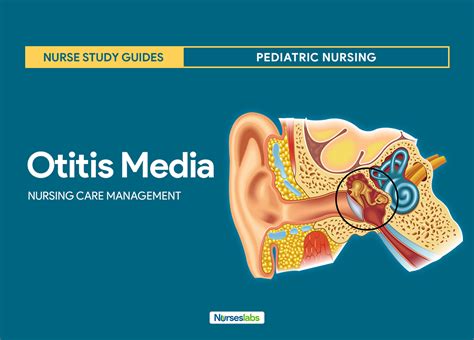 Otitis Media Nursing Diagnosis Interventions And Care