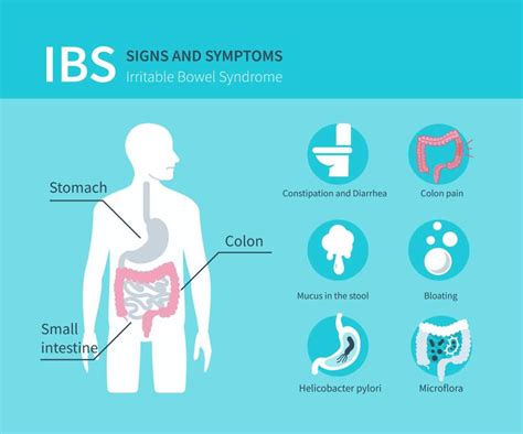 Irritable Bowel Syndrome Symptom Treatment