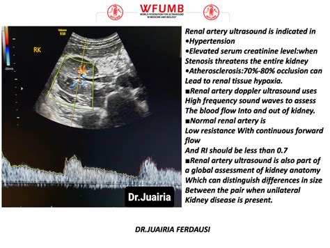 Ultrasound The Best 19 Doppler Of Renal Artery Wfumb