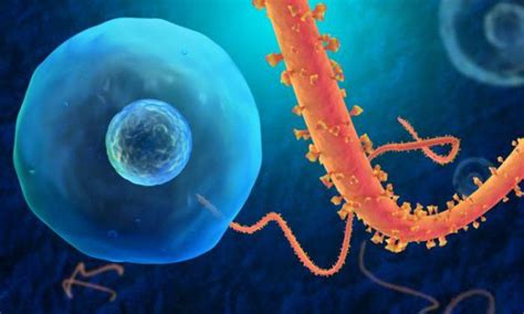 We did not find results for: Ebola 2014: The Deadliest Outbreak of the Virus in History ...