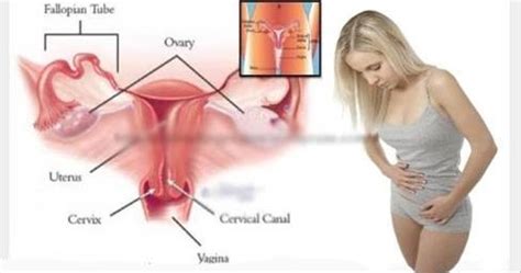 Tanda tanda kanser rahim tahap 4. Wanita WAJIB Baca..!! Inilah Tanda-Tanda MENGETAHUI Kanser ...