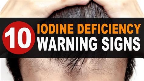 10 Iodine Deficiency Warning Signs Iodine Deficiency Iodine Iodine