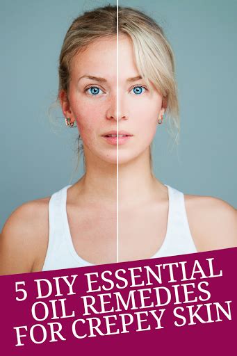 How To Get Rid Of Crepey Skin With 5 Diy Essential Oil Remedies