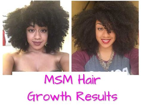 Zhinae moor recommends wild growth hair care. MSM Hair Growth Before and After Pictures