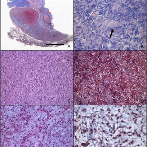 Age Range In Years Of The 70 Dogs With Peripheral Nerve Sheath Tumor