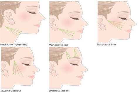 Face Lift Treatment And Cost Guide