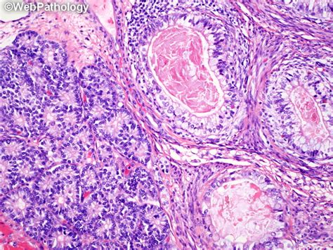A Collection Of Surgical Pathology Images