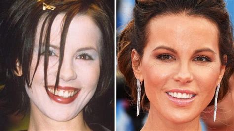 The seventies icon, 63, revealed … Kate Beckinsale Plastic Surgery - With Before And After Photos