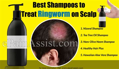Lotriminforringwormonscalpshampoo The Best Antimicrobial Shampoo