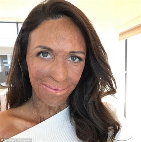 Burns Survivor Turia Pitt Shows Off New Ear Bling Daily Mail Online