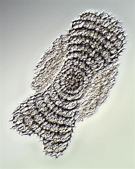 R Amphicras G Pacific Ocean Picture Of Radiolarian Microscopic
