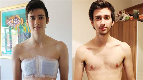 My Gender Transition From Female To Male • Dear Buzzfeed Youtube