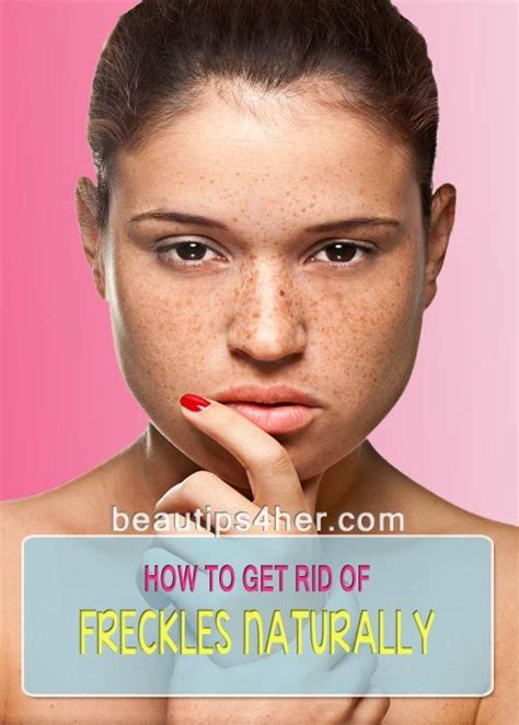 What To Know About A Freckle Becoming Lighter Causes And Risks Justinboey