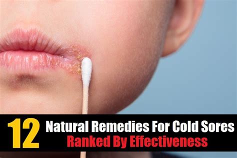 12 Home Remedies For Cold Sores Ranked By Effectiveness Home Remedies