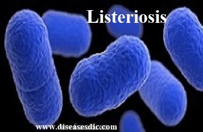 Listeriosis Definition Symptoms Treatment And Prevention