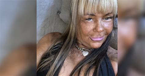 Tan Mom Patricia Krentcil Claims She Cut Down On Tanning