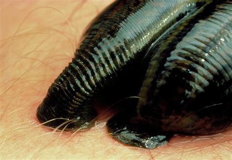 Medicinal Leech Sucking Blood From Human Arm Photograph By Martin Dohrn