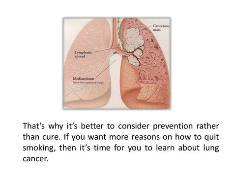 the stages of lung cancer caused by smoking